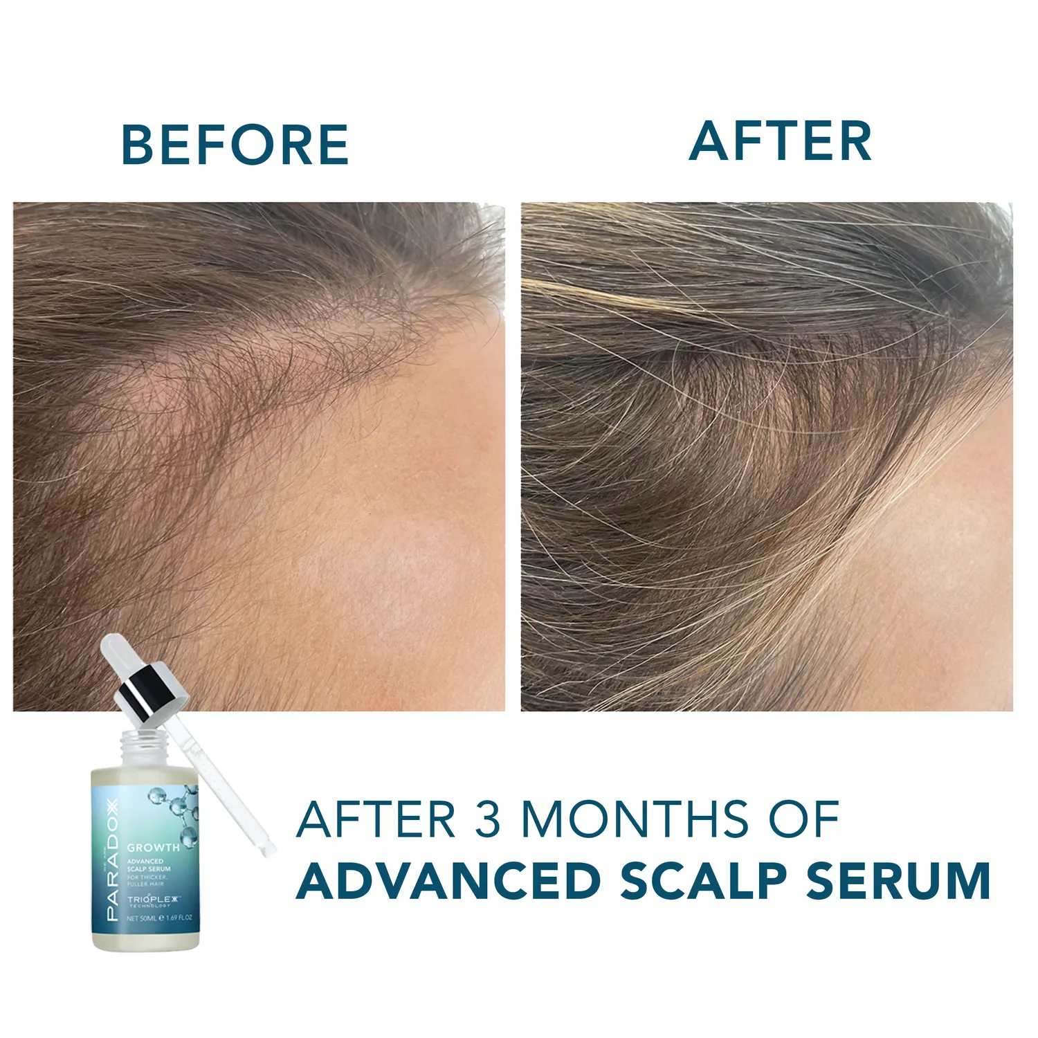 We Are Paradoxx Advanced Scalp Serum siero 50ml anticaduta