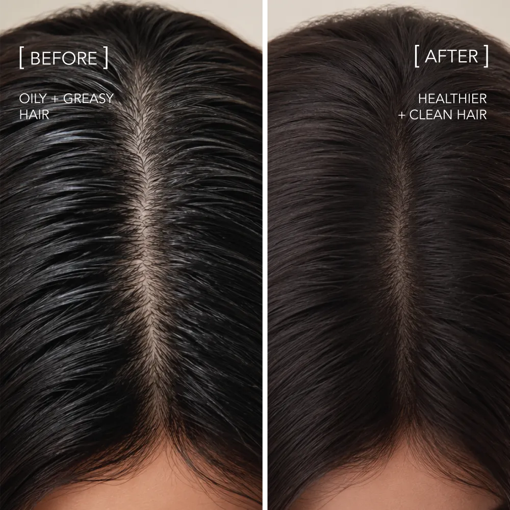 We are paradoxx Scalp Longevity shampoo secco polvere volume